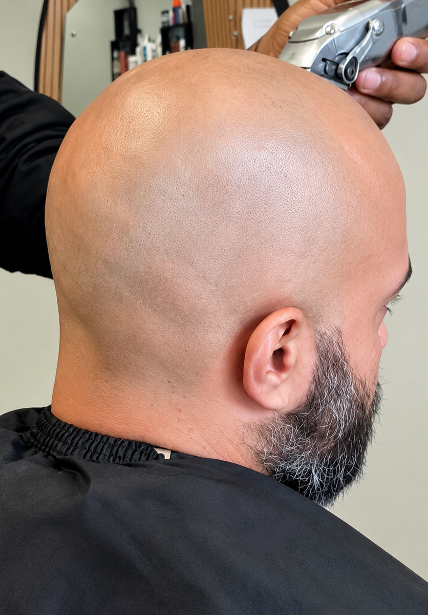Chiskop